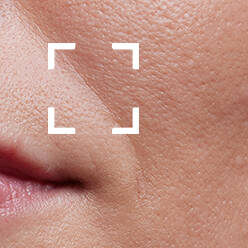 Anti-Aging